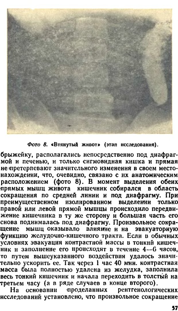 📖 DJVU. Самовнушение и его влияние на организм человека. Ромен А. Страница 56. Читать онлайн djvu