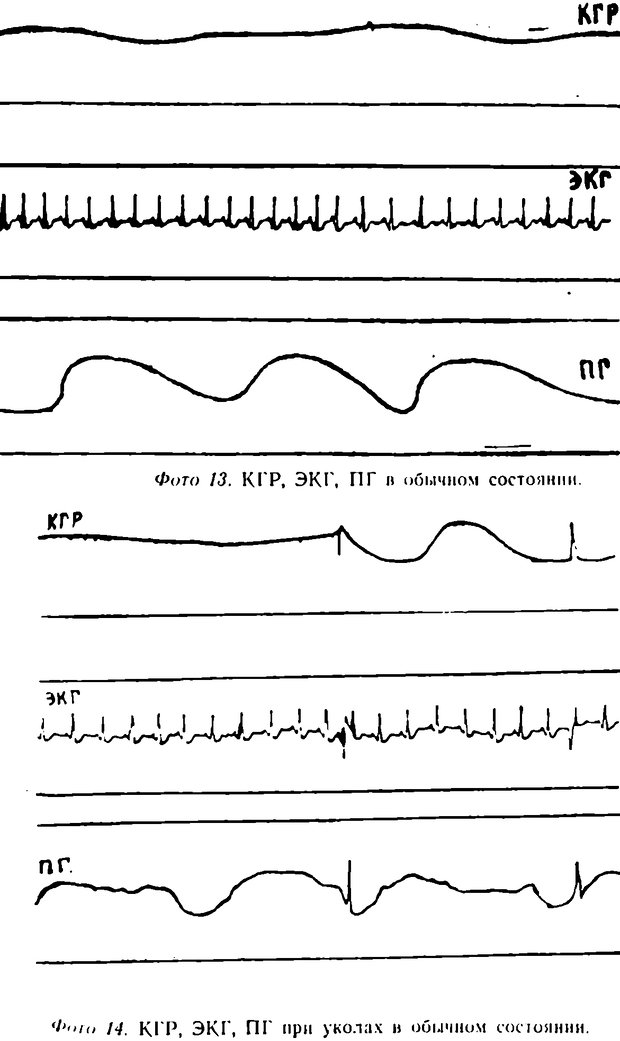 📖 DJVU. Самовнушение и его влияние на организм человека. Ромен А. Страница 66. Читать онлайн djvu
