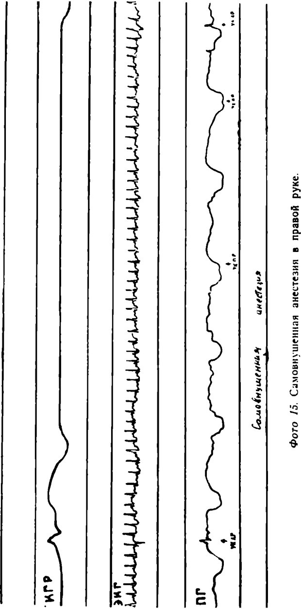 📖 DJVU. Самовнушение и его влияние на организм человека. Ромен А. Страница 67. Читать онлайн djvu